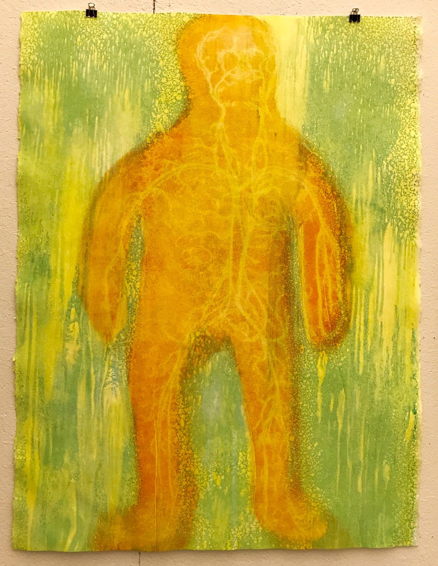 hesgotradioactivebloodii